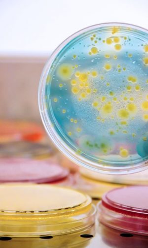 Inicio Bacterias